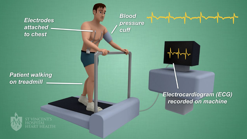 What Is a Stress Test and When to Schedule One?